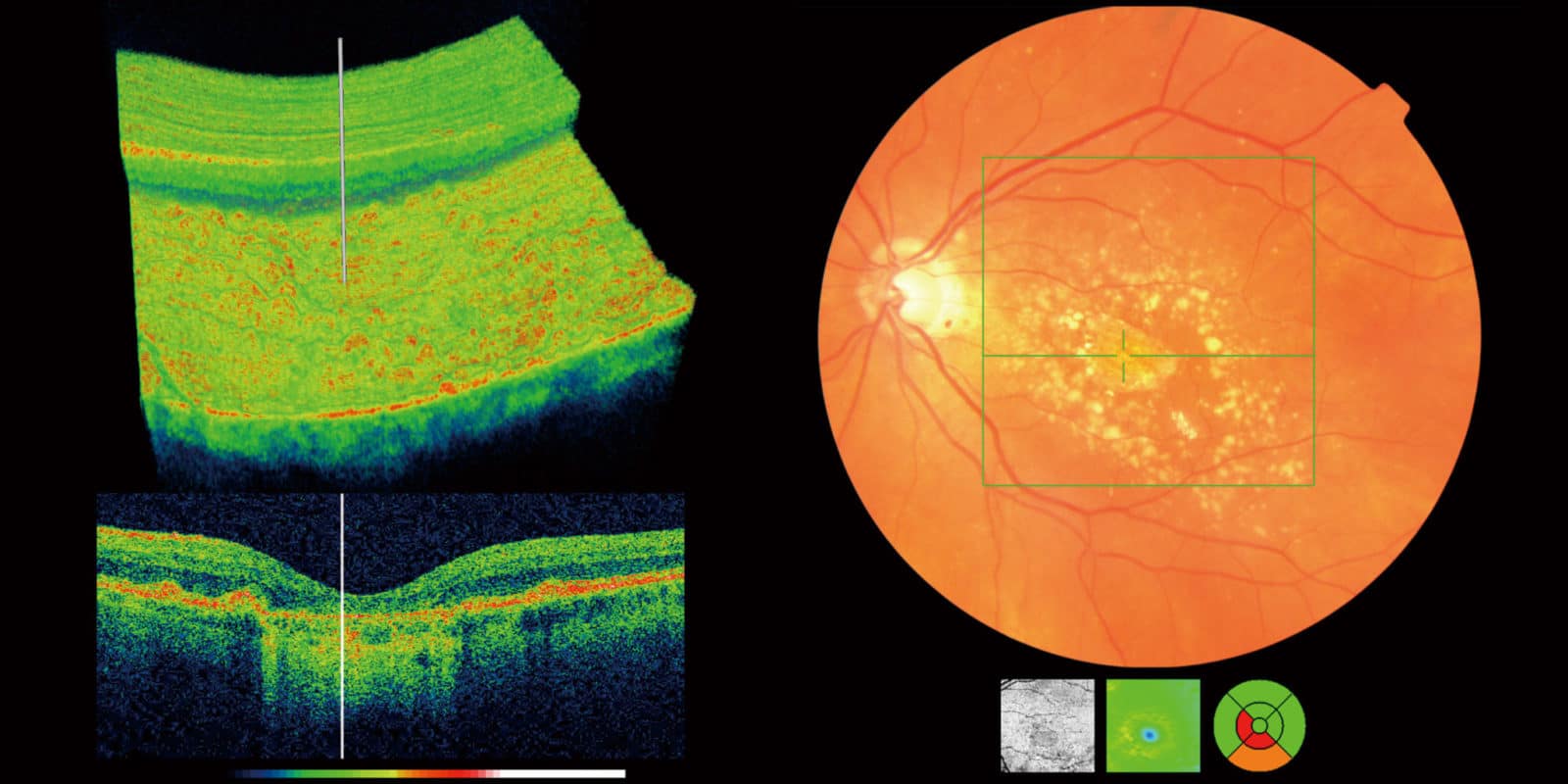 how-much-is-an-eye-test-ace-eyewear